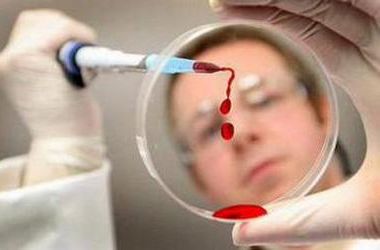 Ученые создают новую вакцину от ВИЧ