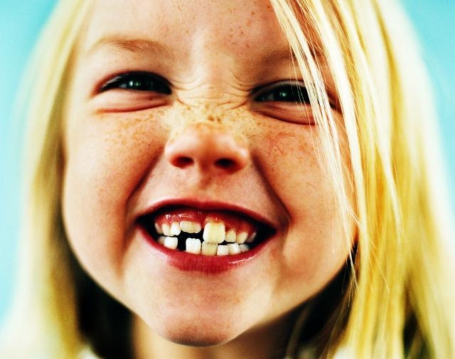 Детская стоматология: все о первых зубах